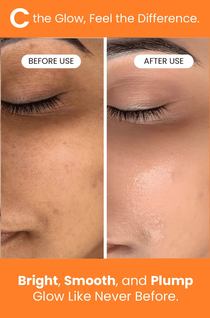 C-Glow Vitamin C Serum